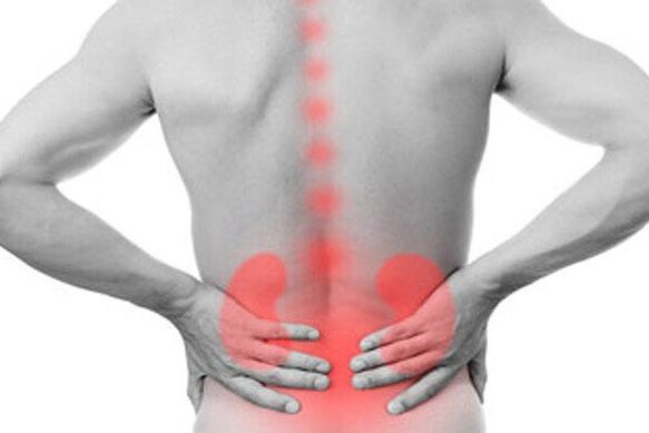 Kidney pathology can provoke pain in the lower back