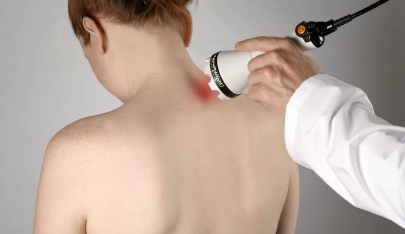 Physiotherapy method for treating cervical osteochondrosis