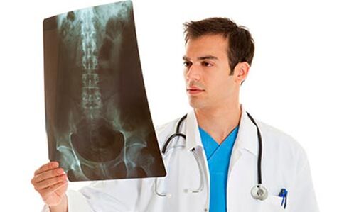 a doctor looking at an x-ray to diagnose low back pain